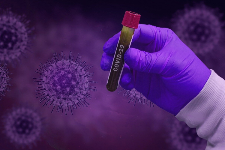 A pozitív tesztek 71 százalékánál azonosították a brit változatot Szlovákiában